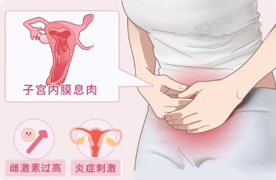 肠道里长了息肉,上厕所时会有 4 个提示,别等到肠癌才后悔!(图5) 肠道里长了息肉,上厕所时会有 4 个提示,别等到肠癌才后悔!(图5)