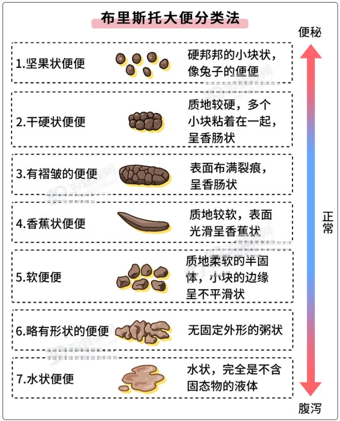 肠道里长了息肉,上厕所时会有 4 个提示,别等到肠癌才后悔!(图3) 肠道里长了息肉,上厕所时会有 4 个提示,别等到肠癌才后悔!(图3)